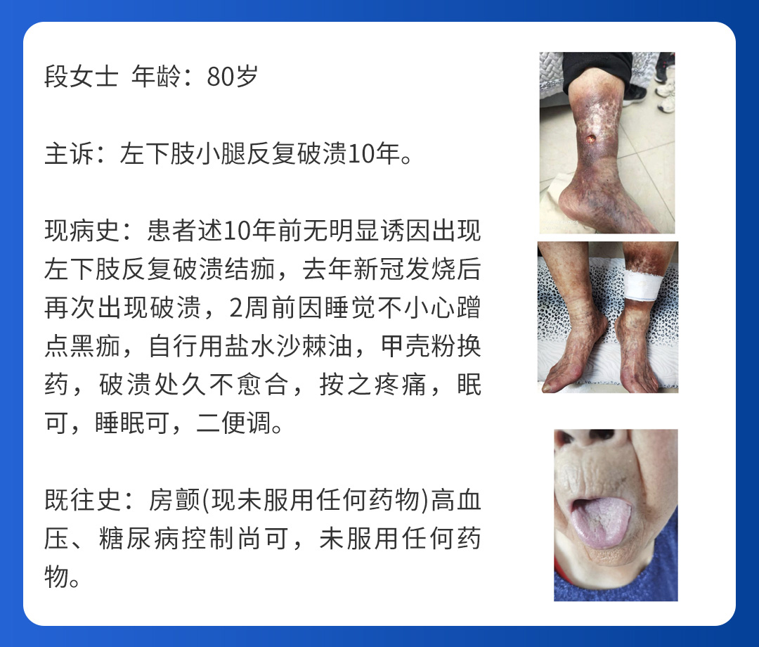 【北京市中西医结合AB在线】第三期会诊(图6)